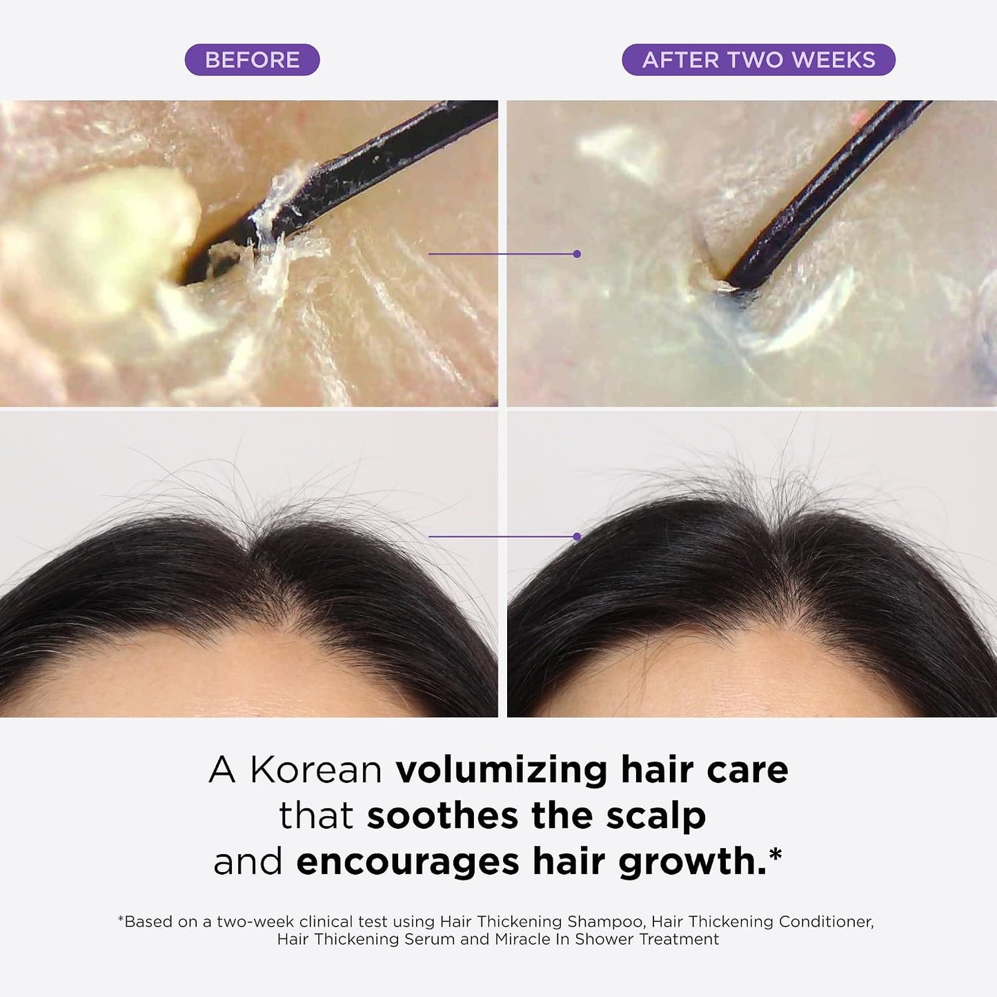 Dr. Groot Scalp Revitalizing Solution Complete Set for Hair Loss